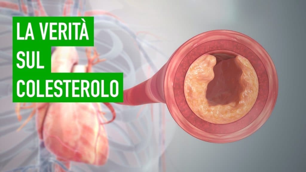 Ketogenic diet and cholesterol, here's why cholesterol is not the enemy